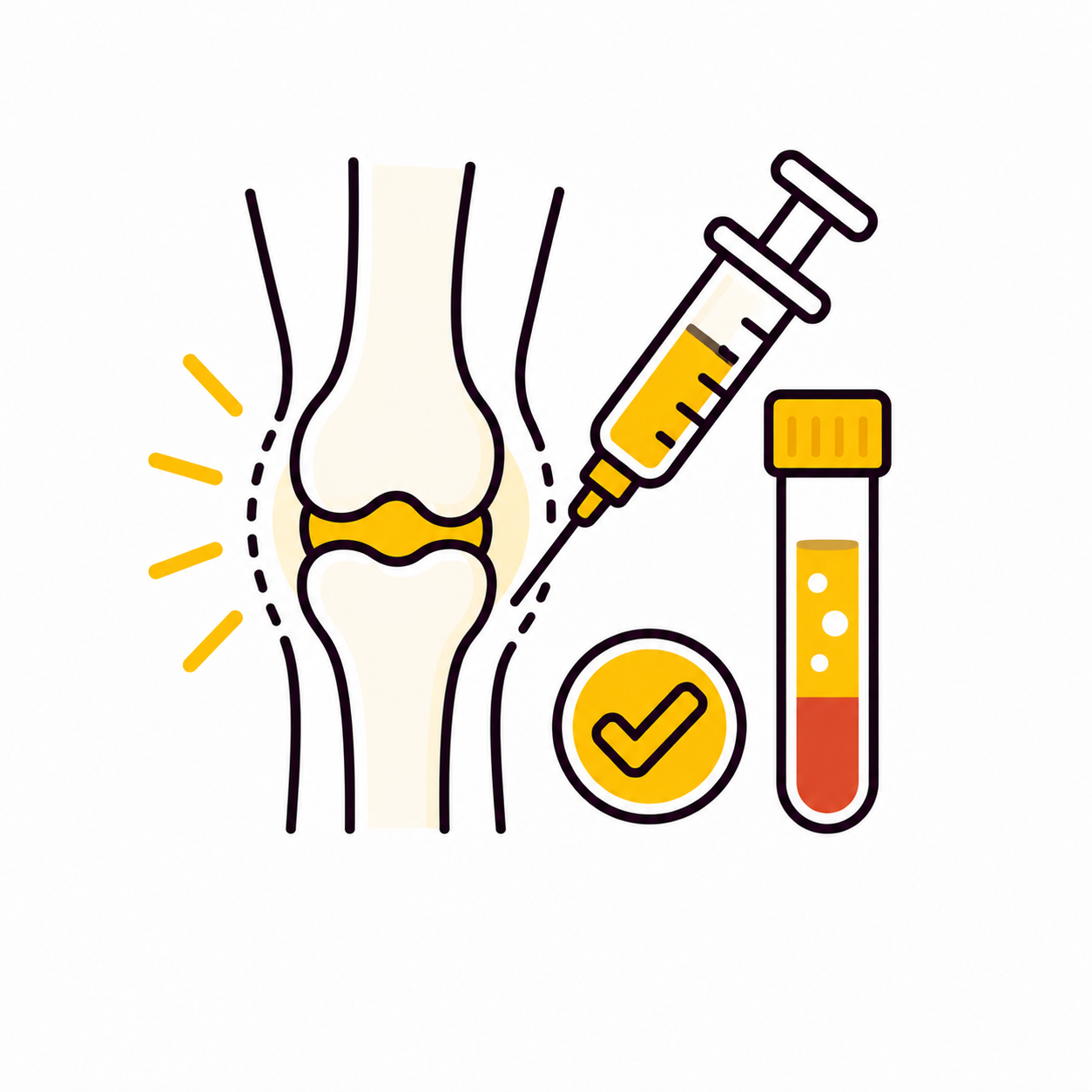 Arthritis, Joint Pain & PRP Therapy