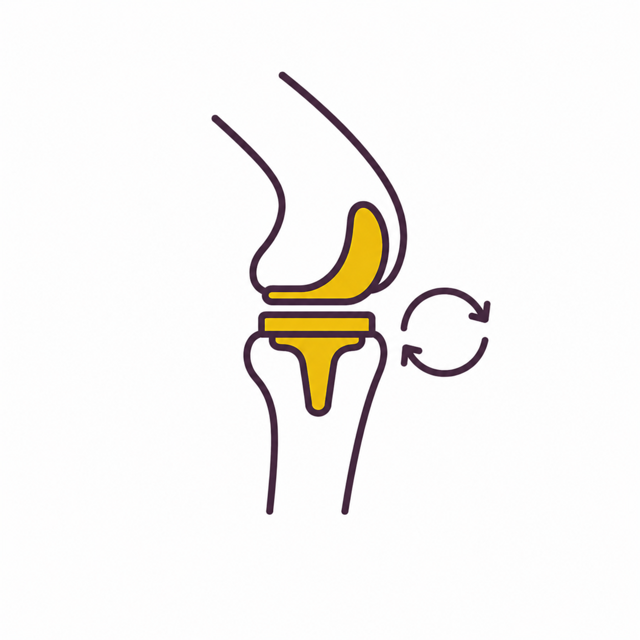 Revision knee replacement