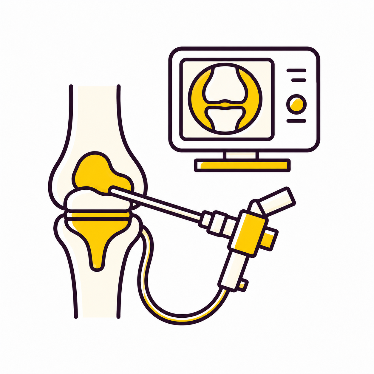 The arthroscopy
