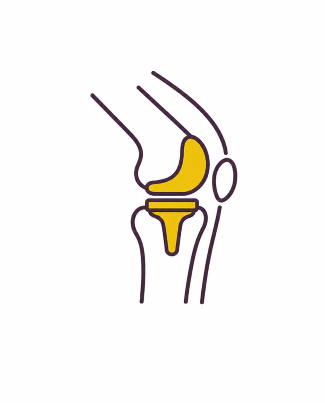 total knee replacement total knee replacement